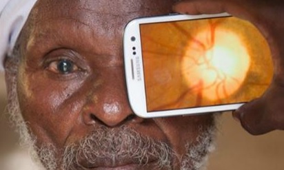 This device turns your phone into an eye exam machine